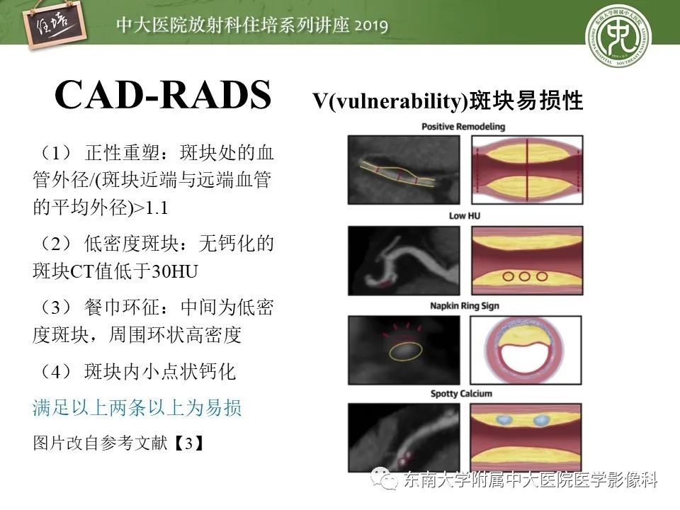 【PPT】冠状动脉CTA诊断流程