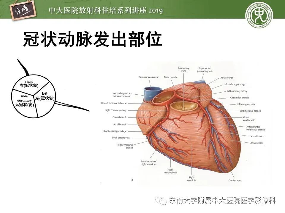 【PPT】冠状动脉CTA诊断流程