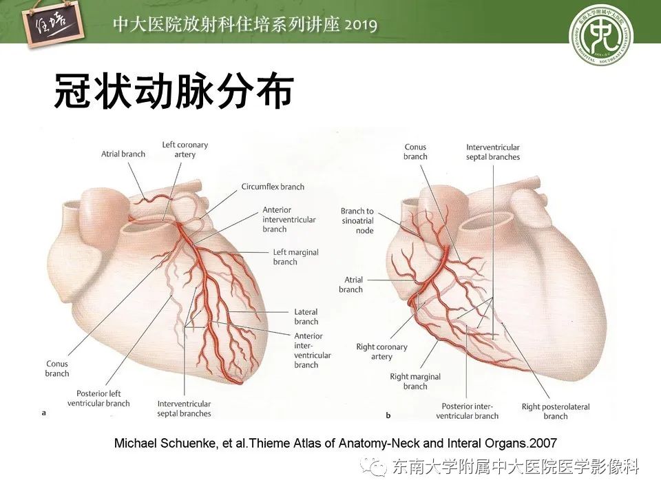 【PPT】冠状动脉CTA诊断流程