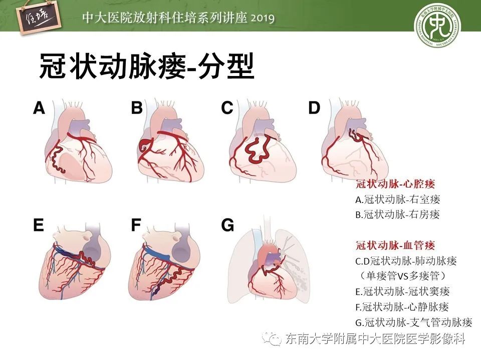 【PPT】冠状动脉CTA诊断流程