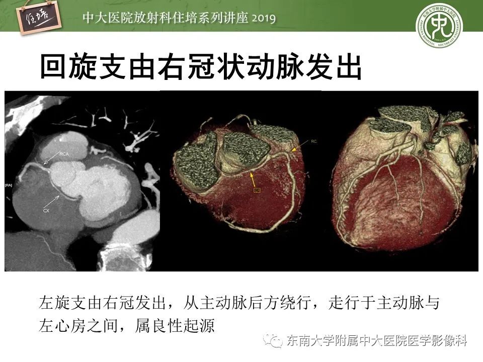 【PPT】冠状动脉CTA诊断流程