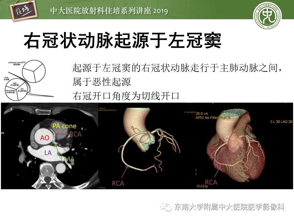 【PPT】冠状动脉CTA诊断流程