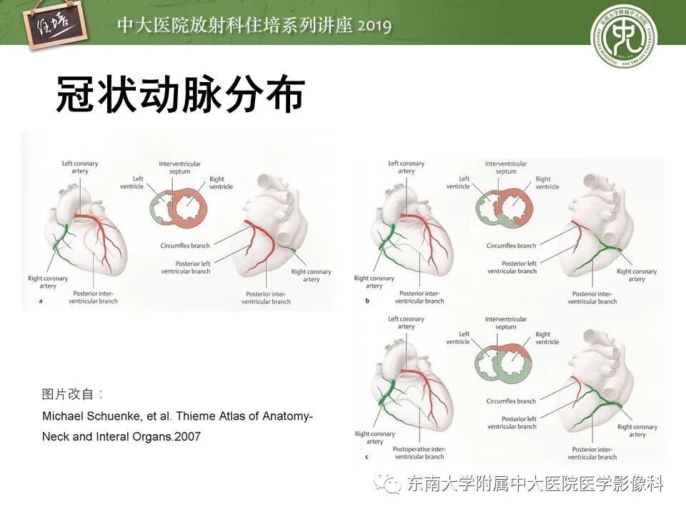 【PPT】冠状动脉CTA诊断流程