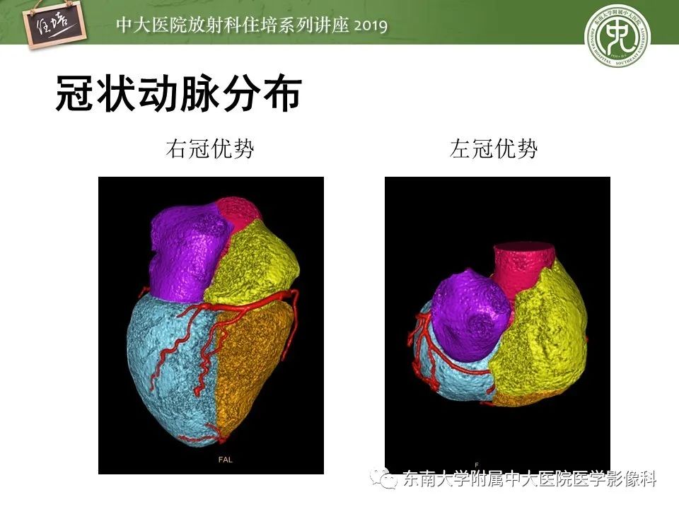 【PPT】冠状动脉CTA诊断流程
