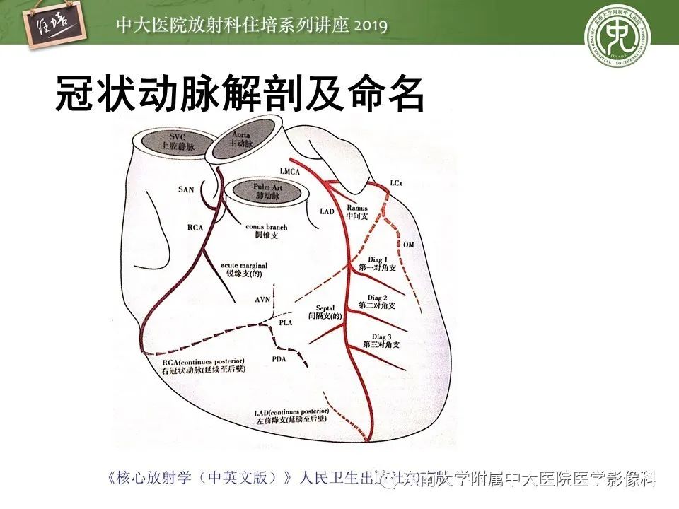 【PPT】冠状动脉CTA诊断流程