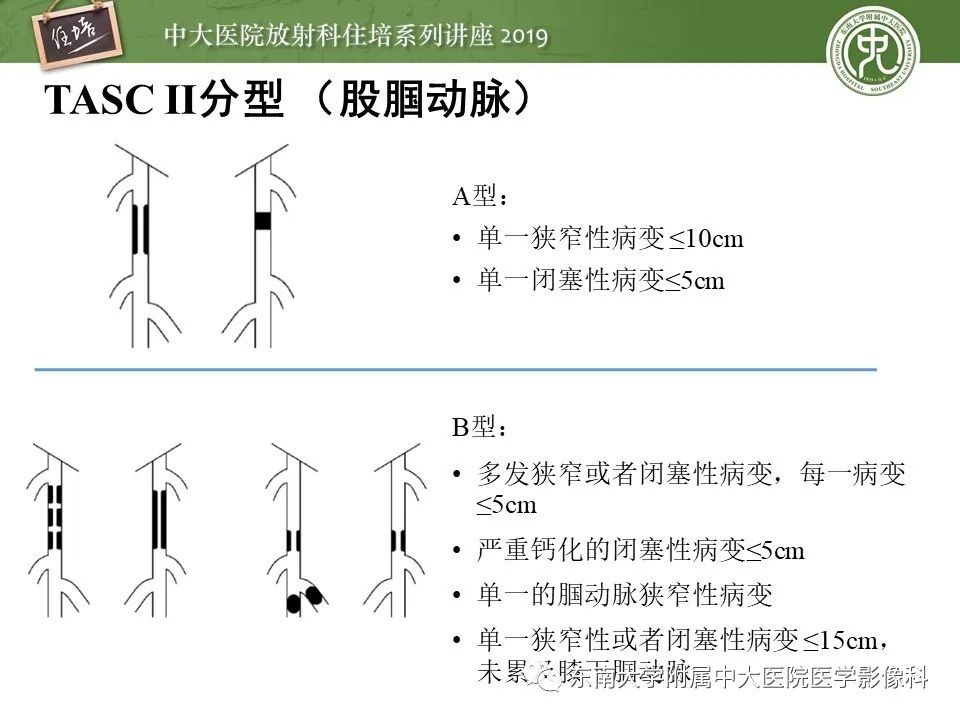 【PPT】下肢CTA的检查流程及评价