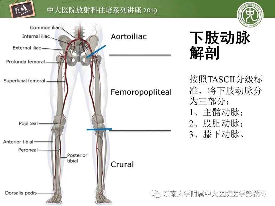 【PPT】下肢CTA的检查流程及评价