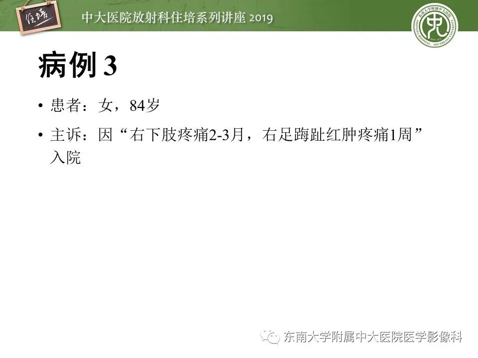 【PPT】下肢CTA的检查流程及评价