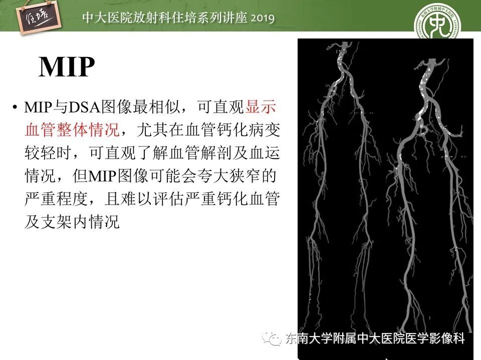 【PPT】下肢CTA的检查流程及评价