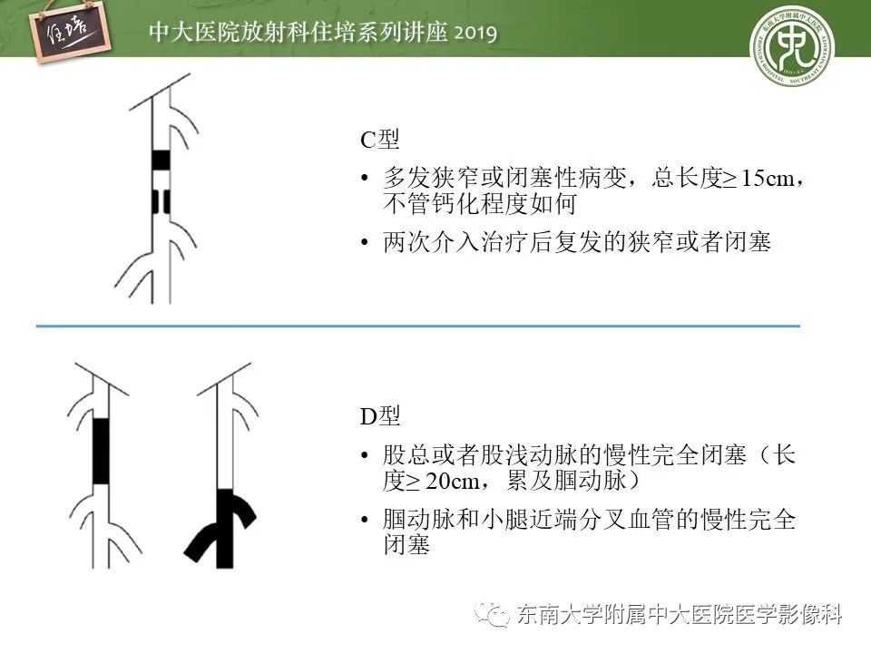 【PPT】下肢CTA的检查流程及评价