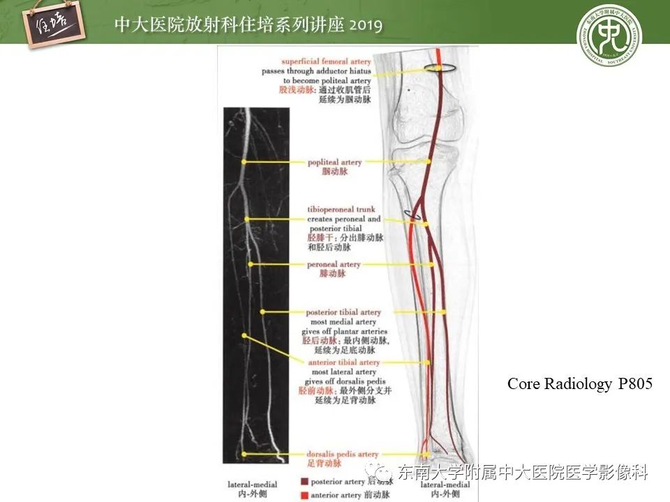 【PPT】下肢CTA的检查流程及评价