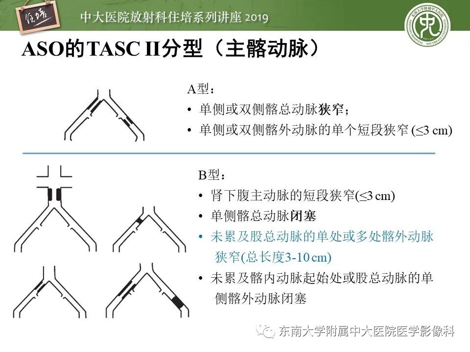 【PPT】下肢CTA的检查流程及评价