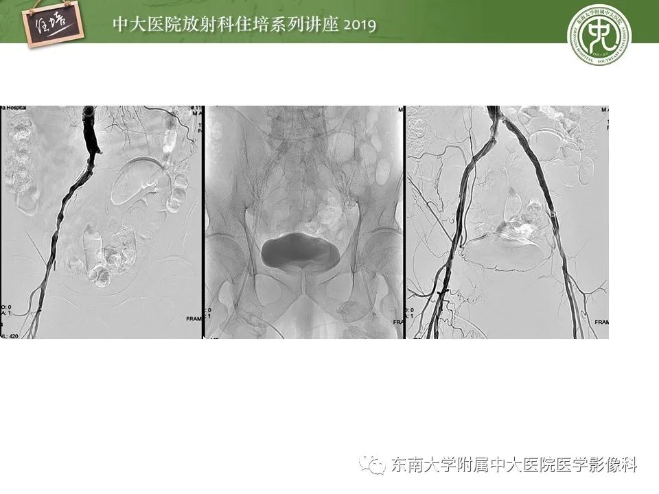 【PPT】下肢CTA的检查流程及评价