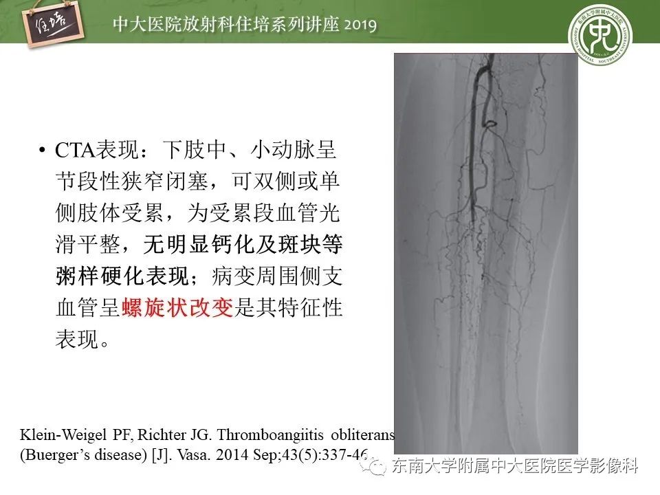 【PPT】下肢CTA的检查流程及评价