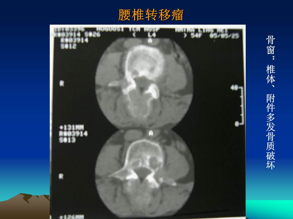 幻灯片29