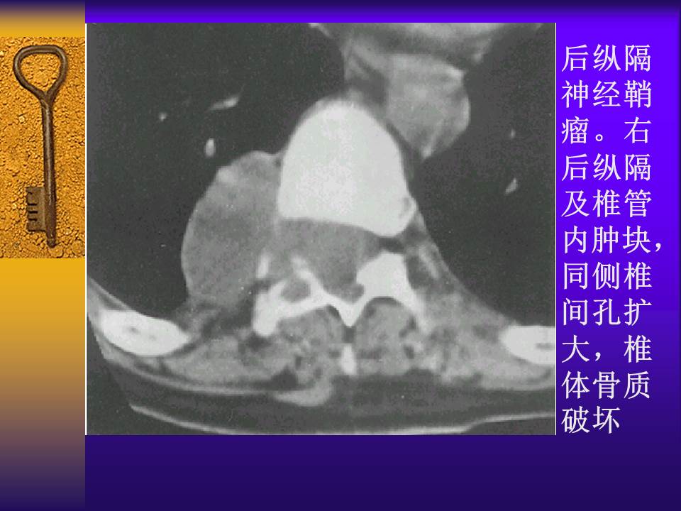 幻灯片59