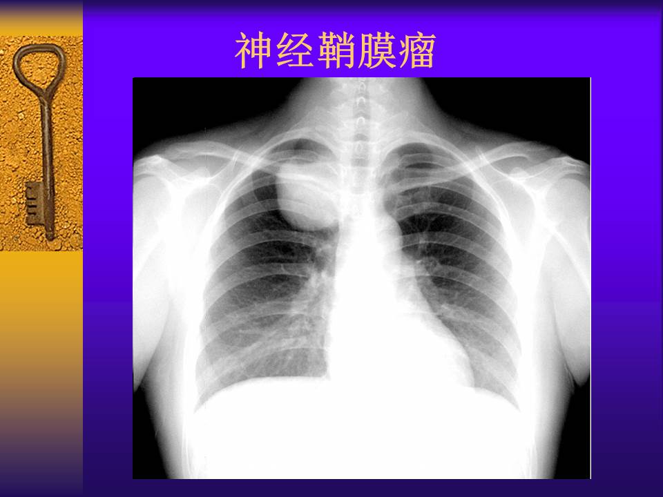 幻灯片48