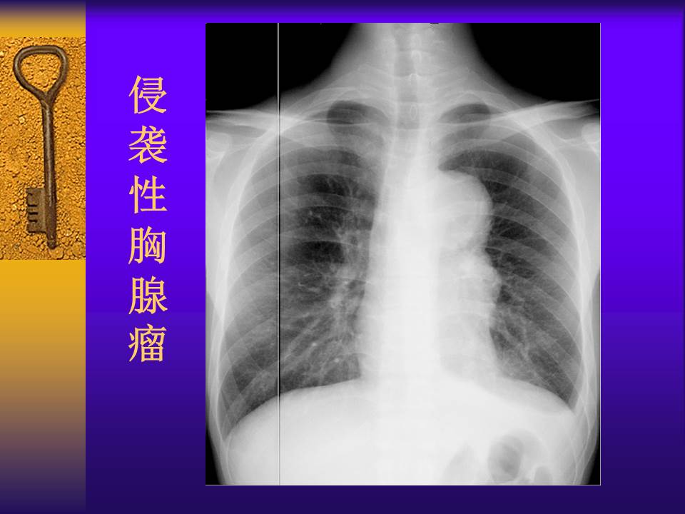 幻灯片21