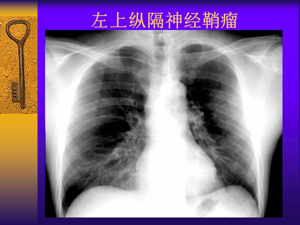 幻灯片52