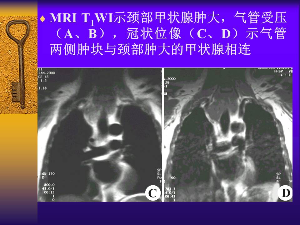 幻灯片11