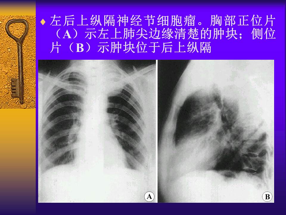 幻灯片47