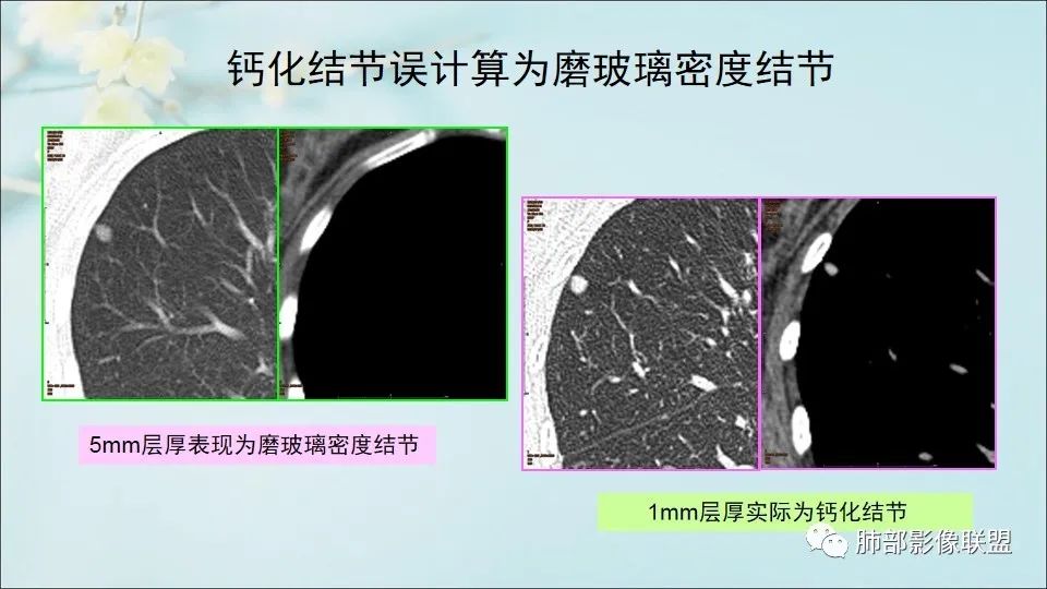 【PPT】重视针对肺GGO的战略转移