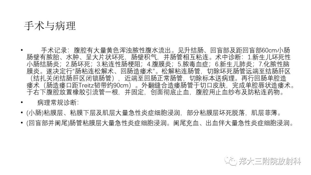 【PPT】新生儿坏死性小肠结肠炎 【PPT】新生儿坏死性小肠结肠炎