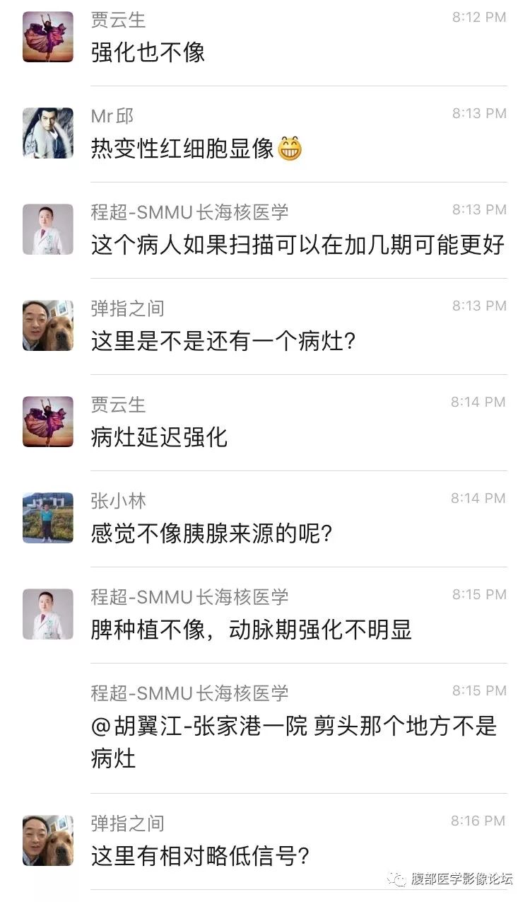 【病例】胰尾局灶性慢性胰腺炎1例MR影像讨论