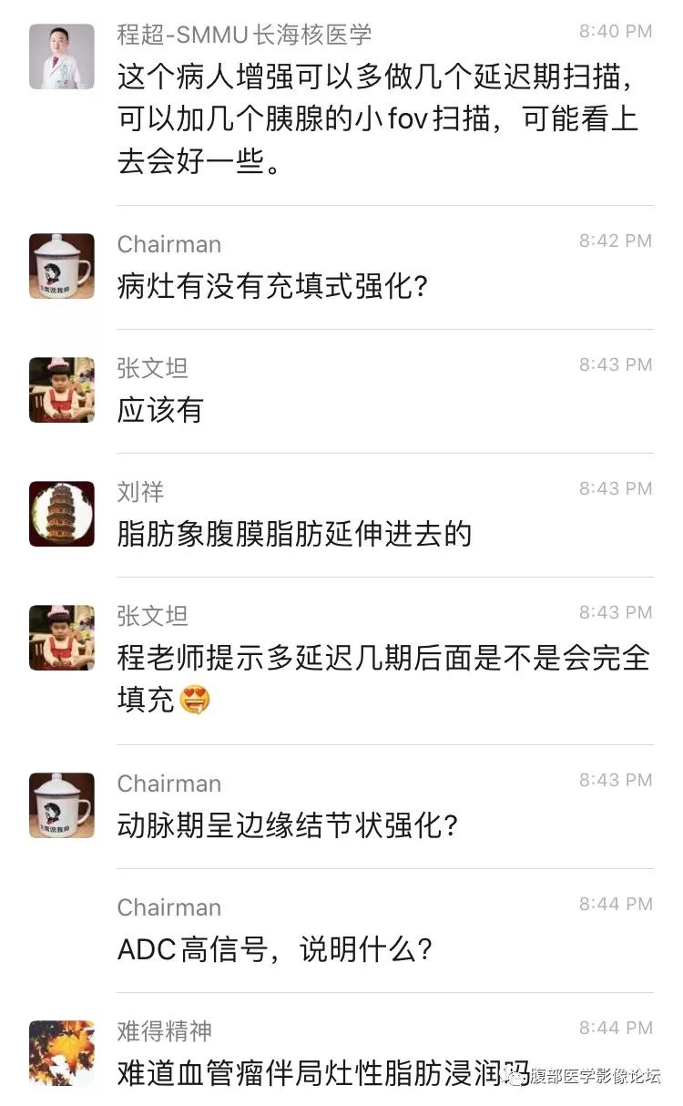 【病例】胰尾局灶性慢性胰腺炎1例MR影像讨论