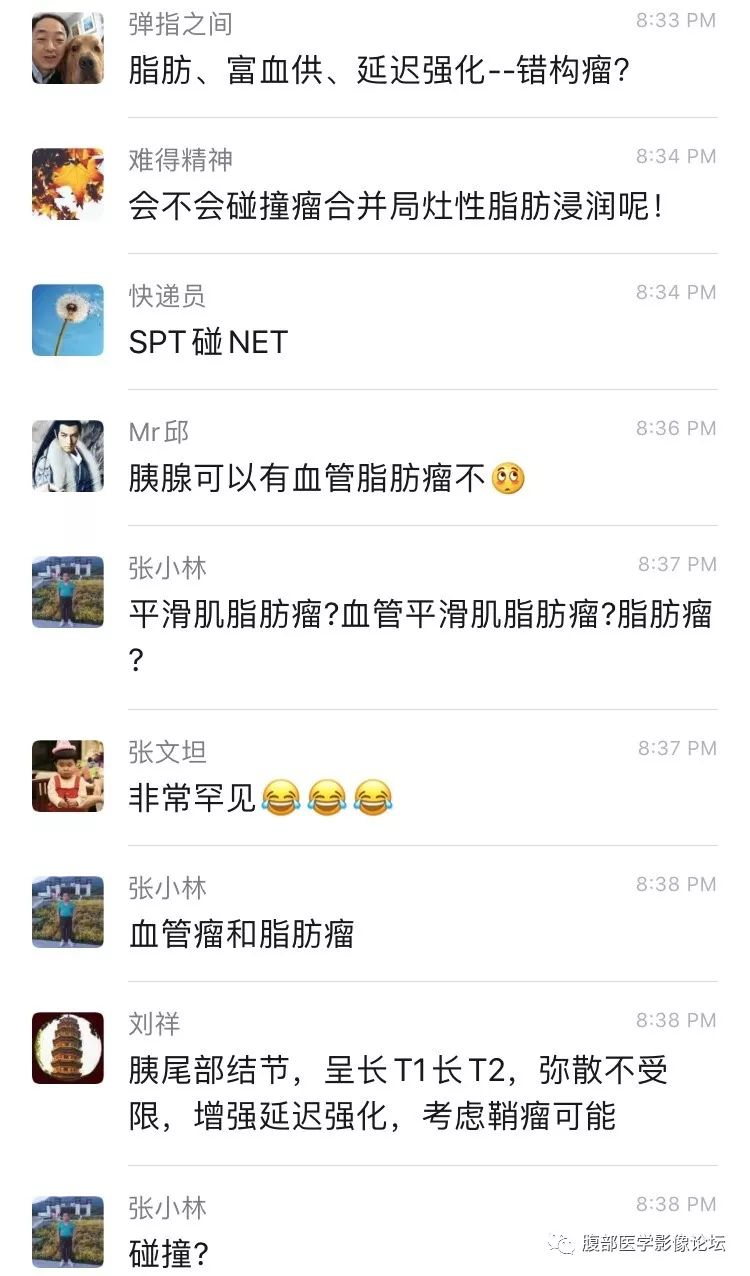 【病例】胰尾局灶性慢性胰腺炎1例MR影像讨论