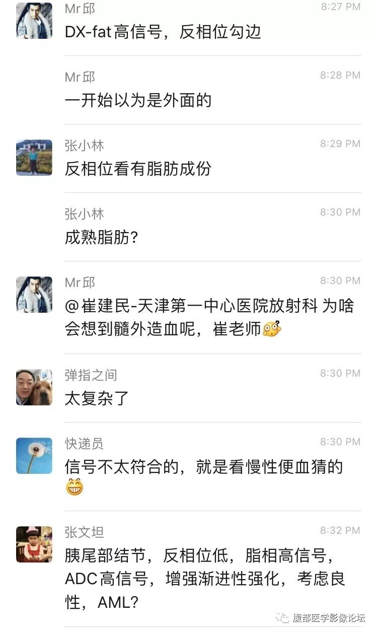 【病例】胰尾局灶性慢性胰腺炎1例MR影像讨论