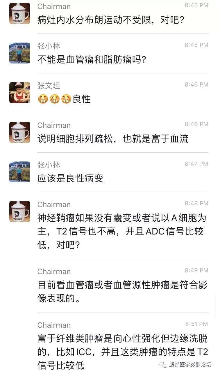 【病例】胰尾局灶性慢性胰腺炎1例MR影像讨论