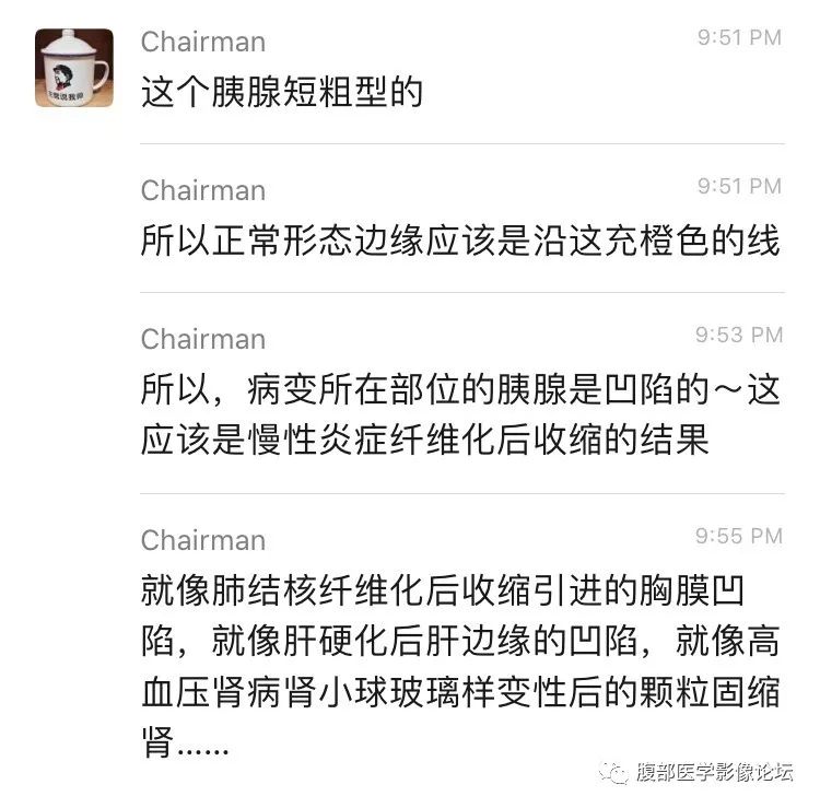 【病例】胰尾局灶性慢性胰腺炎1例MR影像讨论