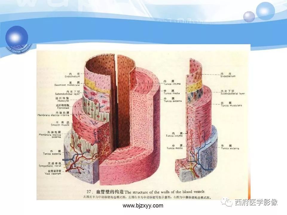 【PPT】主动脉壁间血肿的CT诊断