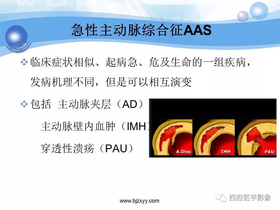 【PPT】主动脉壁间血肿的CT诊断