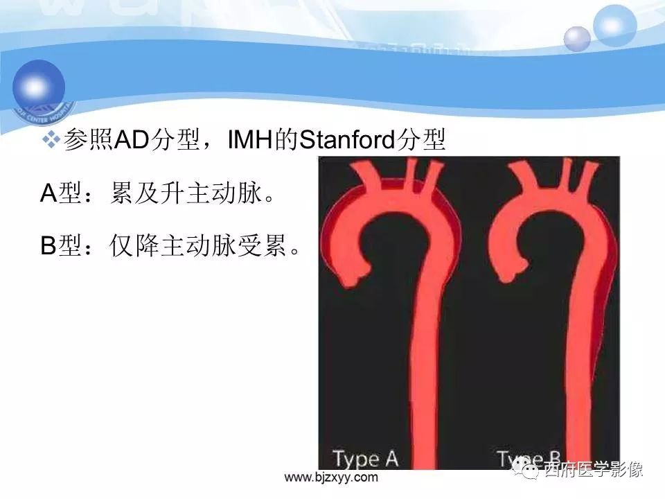 【PPT】主动脉壁间血肿的CT诊断