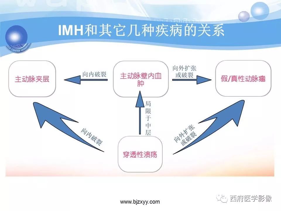 【PPT】主动脉壁间血肿的CT诊断