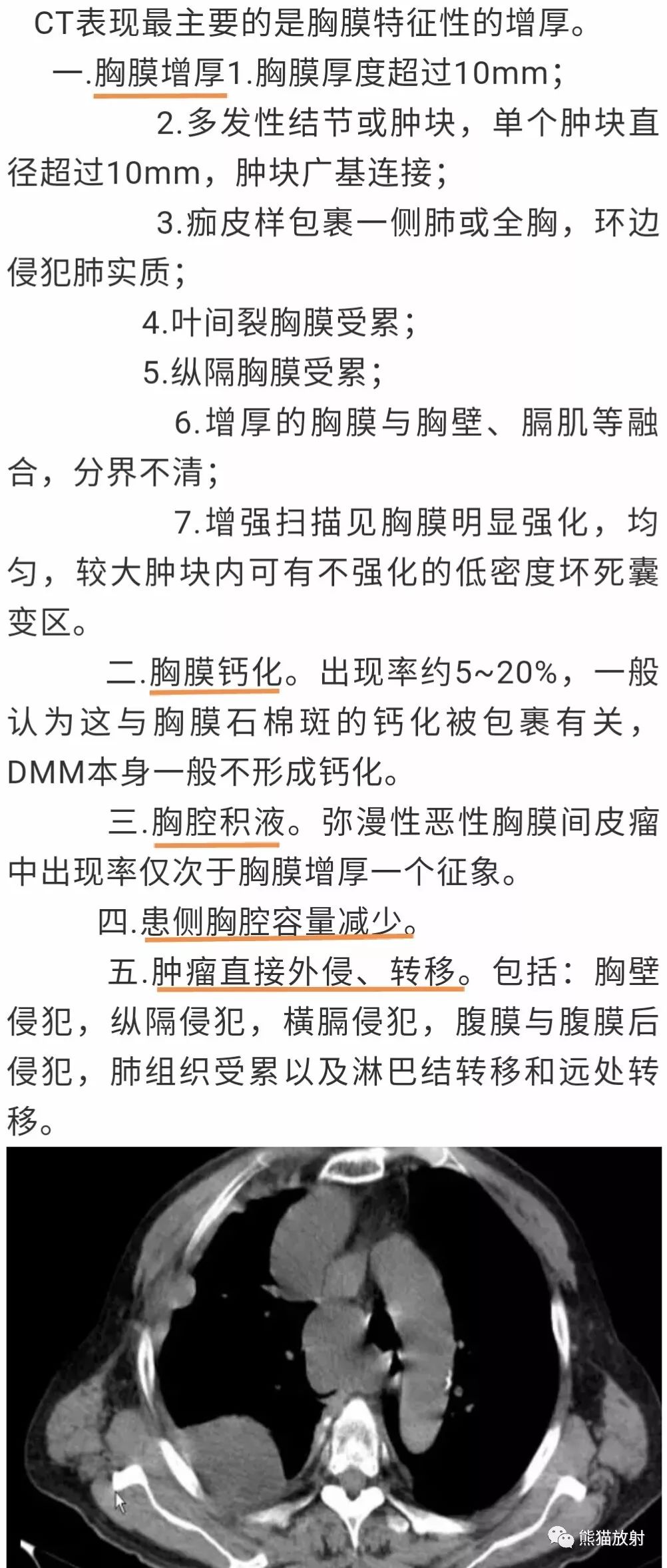 胸膜间皮瘤的CT影像鉴别