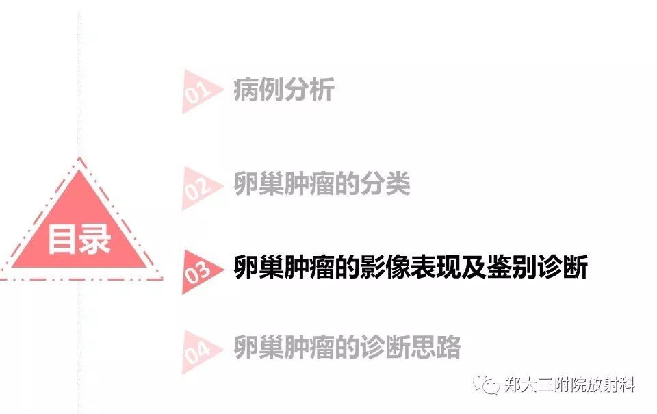 【PPT】卵巢肿瘤的影像诊断思路 【PPT】卵巢肿瘤的影像诊断思路