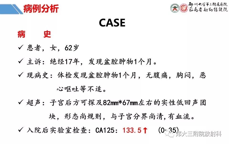 【PPT】卵巢肿瘤的影像诊断思路 【PPT】卵巢肿瘤的影像诊断思路