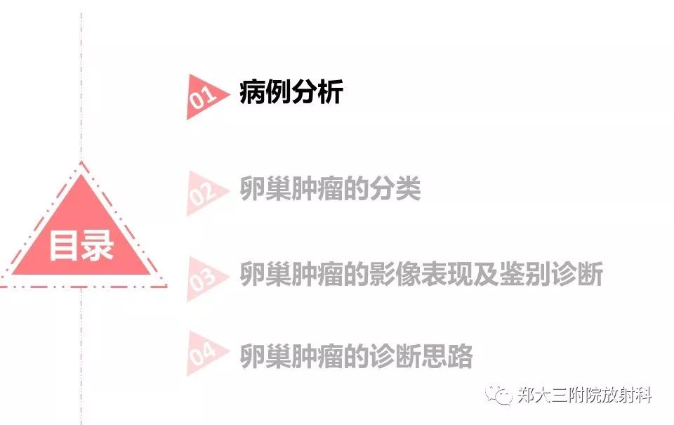 【PPT】卵巢肿瘤的影像诊断思路 【PPT】卵巢肿瘤的影像诊断思路
