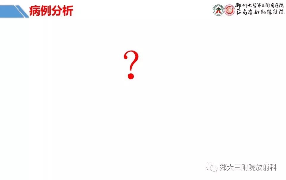 【PPT】卵巢肿瘤的影像诊断思路 【PPT】卵巢肿瘤的影像诊断思路