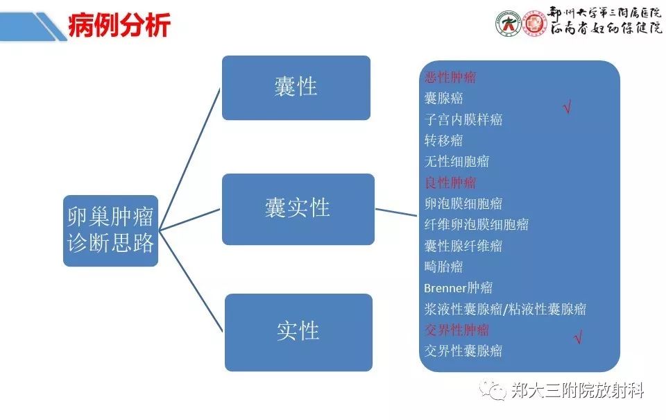 【PPT】卵巢肿瘤的影像诊断思路 【PPT】卵巢肿瘤的影像诊断思路
