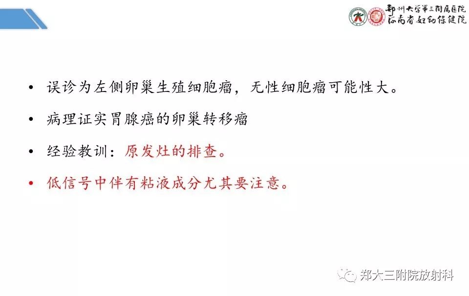 【PPT】卵巢肿瘤的影像诊断思路 【PPT】卵巢肿瘤的影像诊断思路