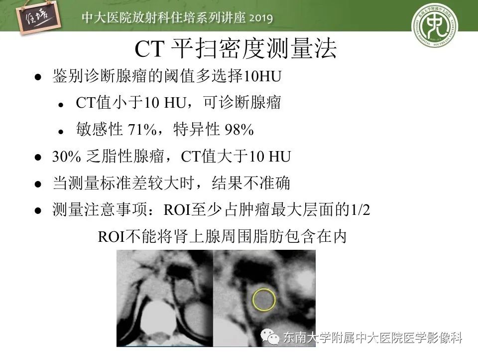 【PPT】肾上腺病变临床与影像思路分析