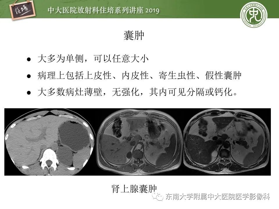 【PPT】肾上腺病变临床与影像思路分析
