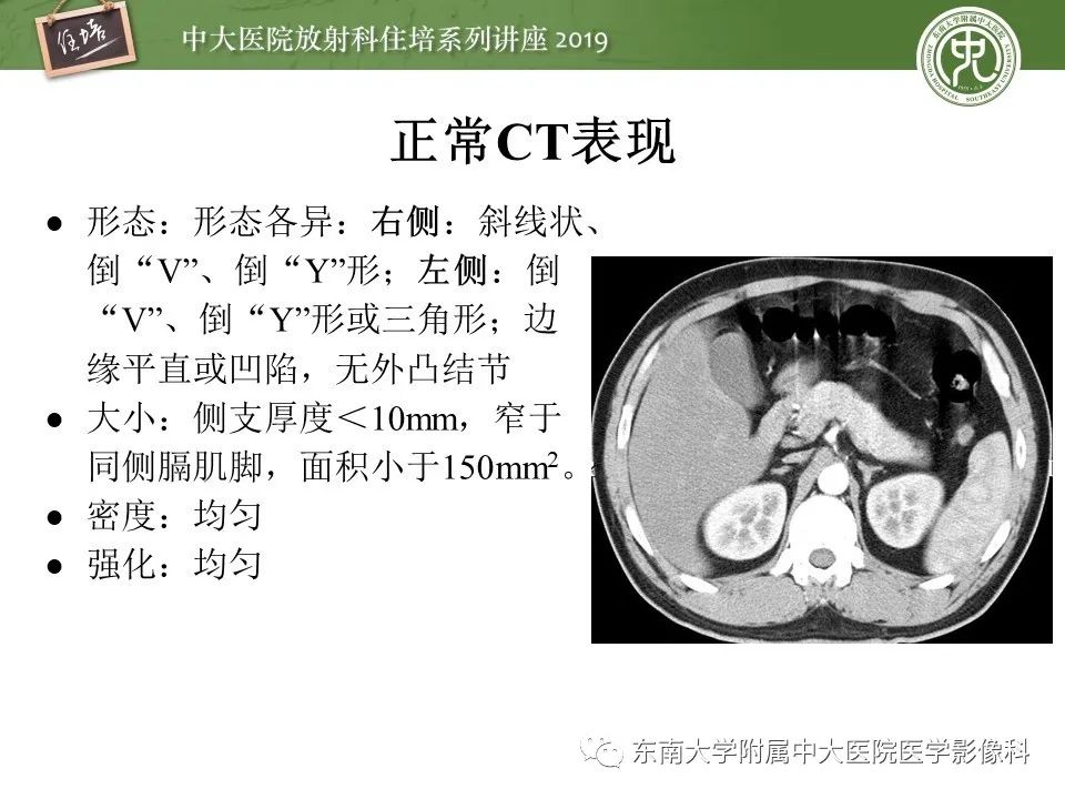 肾上腺病变临床与影像思路分析