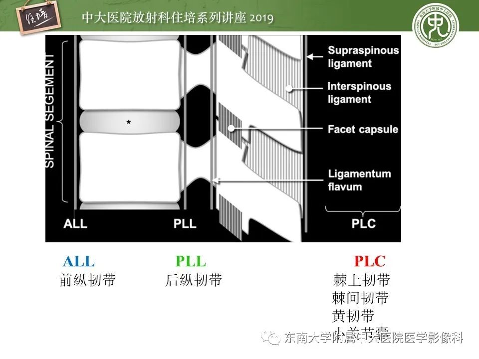 【PPT】脊柱创伤