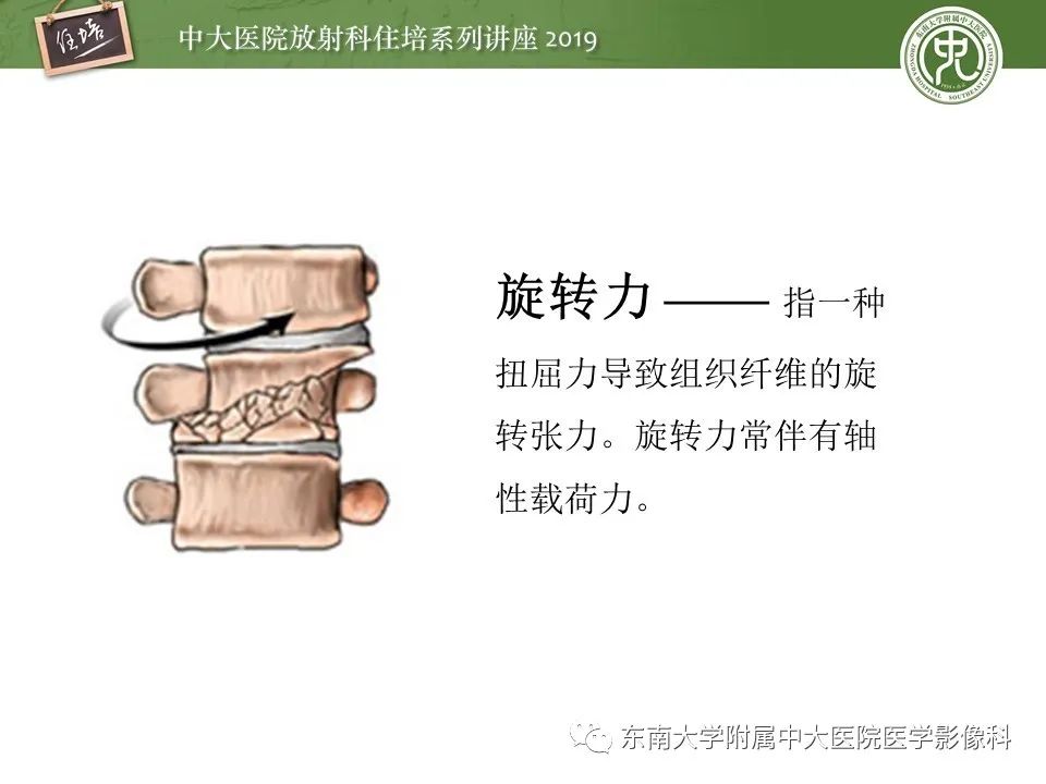 【PPT】脊柱创伤