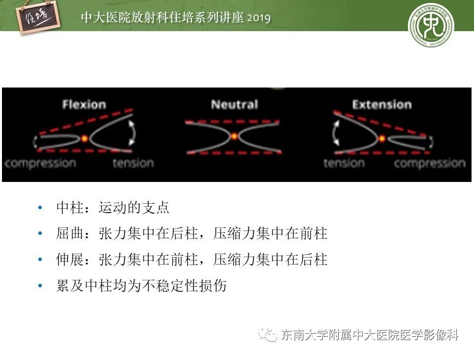 【PPT】脊柱创伤